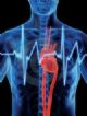 Emerging Countries Cardiovascular Devices Market to 2017