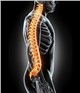 Spine Implants Market - Global Outlook and Forecast 2019-2024