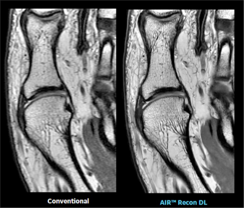 GE Healthcare’s Pioneering Deep Learning Image Reconstruction Technology Benefits More Than 2M Patients Globally